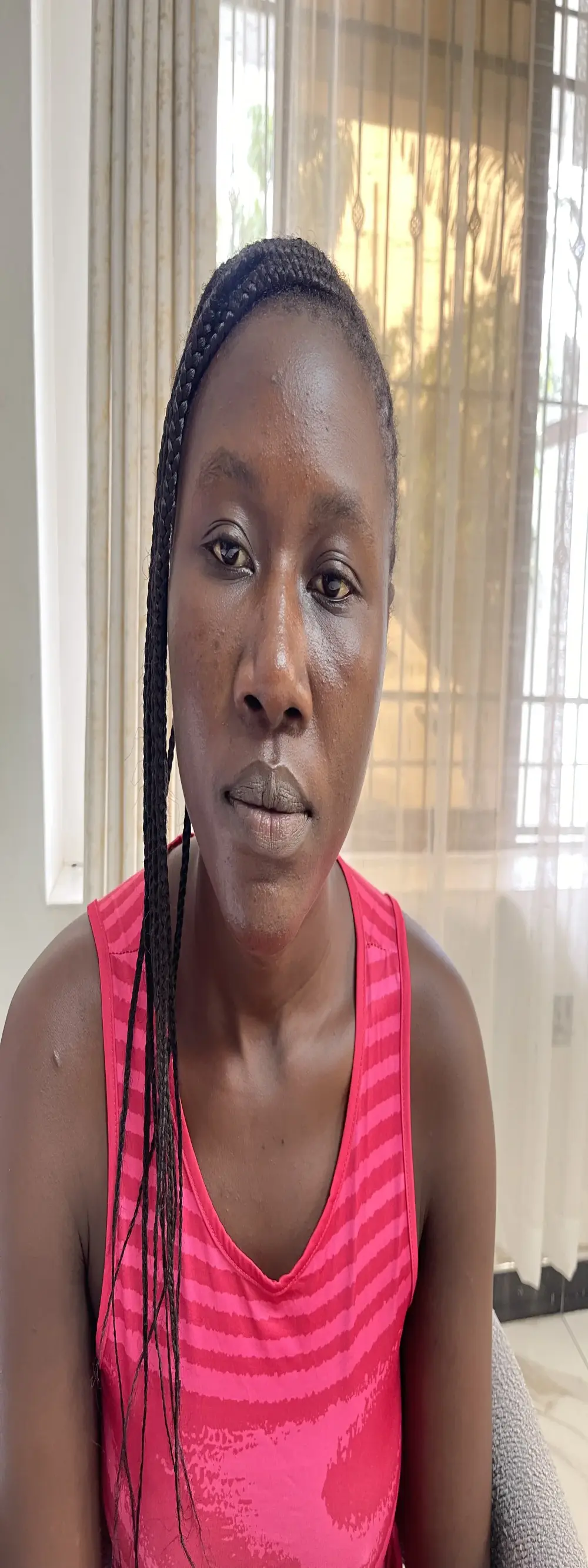 Toxic_melanin